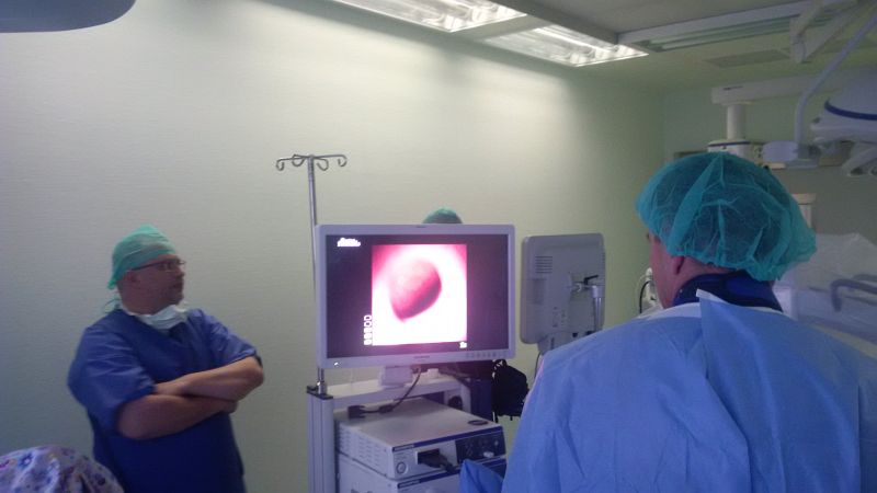 URS LithoVue