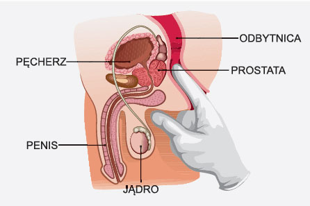 Badanie DRE prostaty
